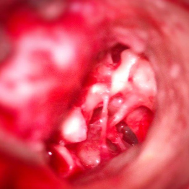 Otology & Microsurgery ??