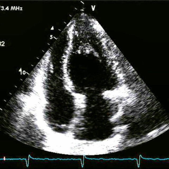Эхокардиография/Кардиология/Echocardiography/Cardiology??‍⚕